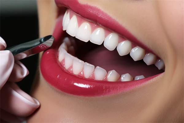 秦皇岛牙科医院排名前十，蓝天口腔全瓷牙项目值得信赖的优质选择！